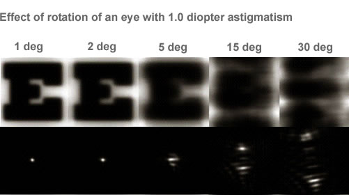 Rotation of the eye prior to treatment degrades image.